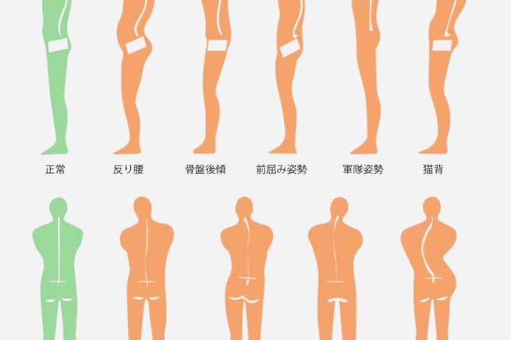 美、姿勢、痛み